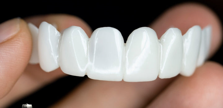 Smile Lens – Justerbar vit tandprotes för omedelbar leendejustering | Karnz