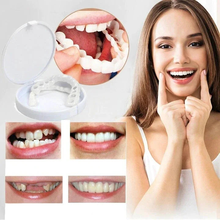Omedelbar försköning av ditt leende med Snap-on-Veneers