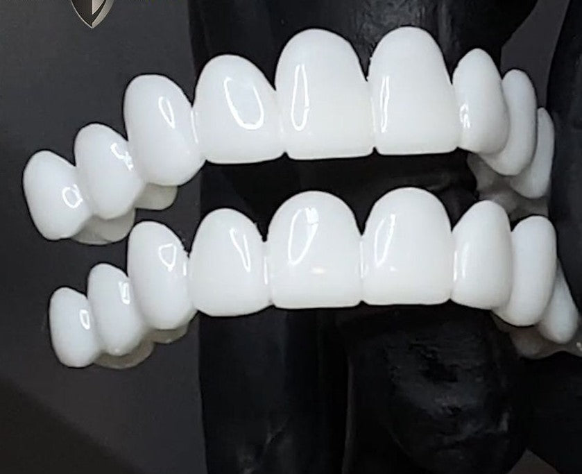 Kosmetiska Tandtoppar SmileShape – Återanvändbara, Flexibla och Naturligt Vita | Karnz