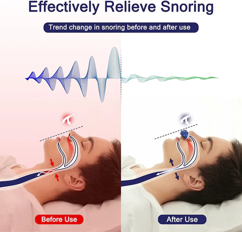 Mikro-CPAP-sömnapparat för resor och mot snarkning