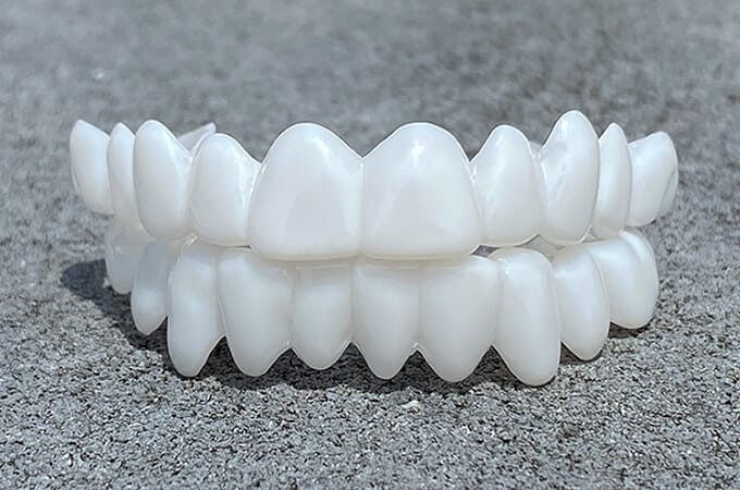 Smile Lens – Justerbar vit tandprotes för omedelbar leendejustering | Karnz