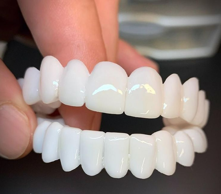 Smile Lens – Justerbar vit tandprotes för omedelbar leendejustering | Karnz