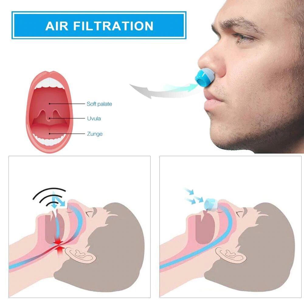 Karnz | Anti-Snarkningsapparat | Slanglös, masklös Mikro-CPAP