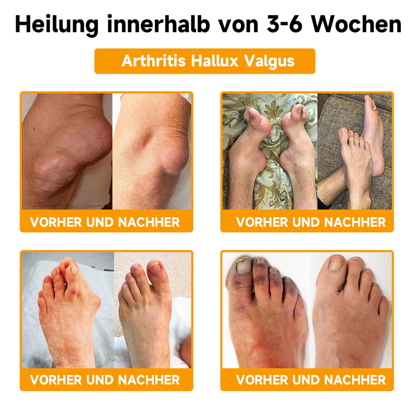 Bienen-Vital-Creme | Snabb smärtlindring | Karnz