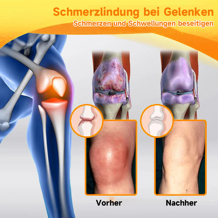 Bienen-Vital-Creme | Snabb smärtlindring | Karnz