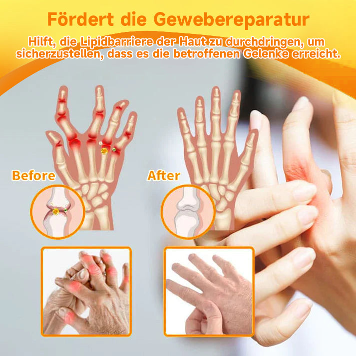 Bienen-Vital-Creme | Snabb smärtlindring | Karnz