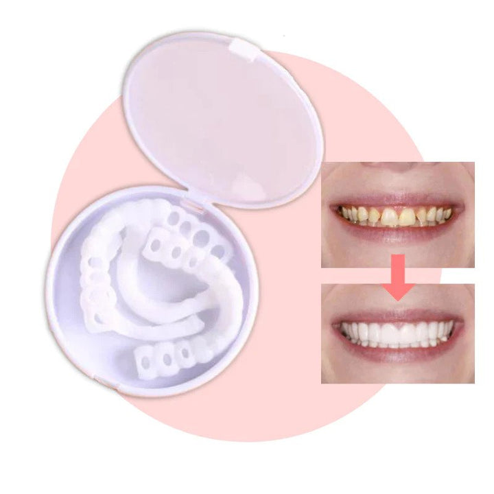 Snap-on Teeth™ – Med dessa skalfasader har du alltid ett perfekt leende.