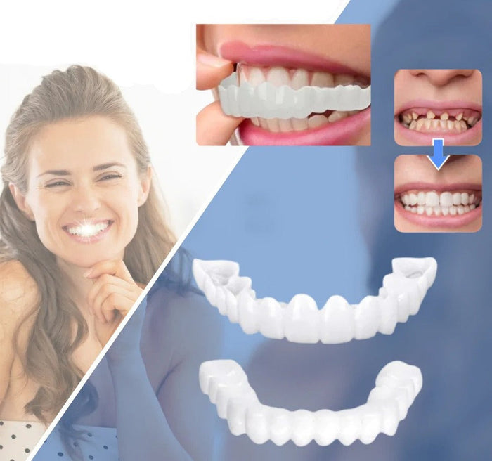 Snap-on Teeth™ – Med dessa skalfasader har du alltid ett perfekt leende.