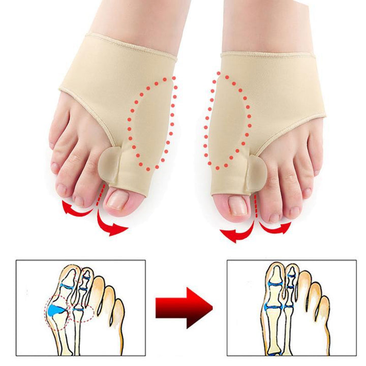 Karnz | Bästa Hallux Valgus Korrigeringsskena Kuddar Lindring Behandling Splint