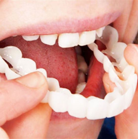 Snap-on Teeth™ – Med dessa skalfasader har du alltid ett perfekt leende.