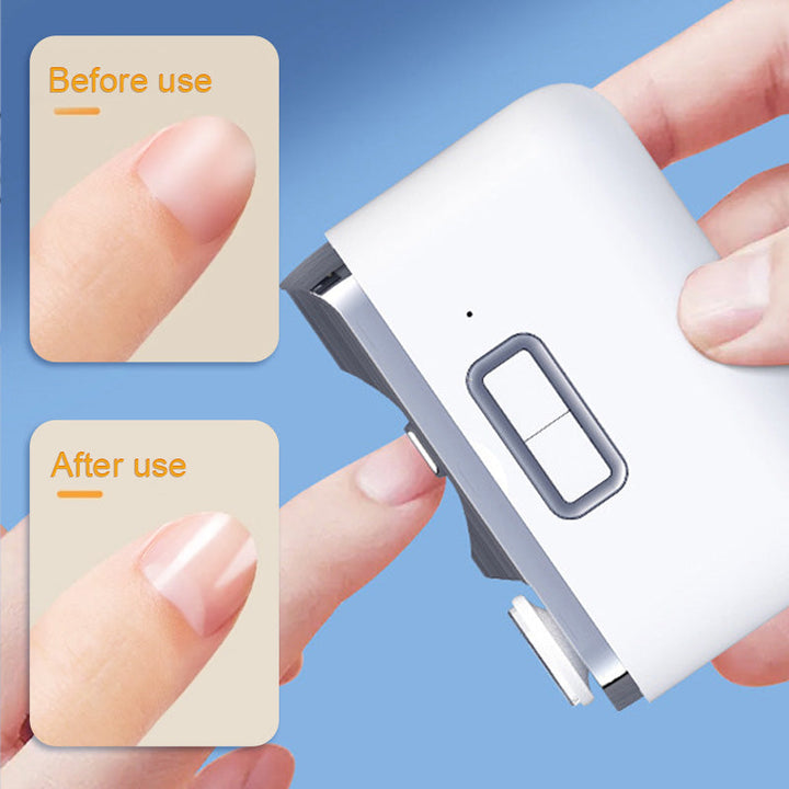 Karnz | Elektrisk tåklippare &amp; polerare | 2 hastighetsinställningar | Inbyggd LED-lampa &amp; avfallshantering | USB-C uppladdningsbar | Säker nagelkortare för äldre &amp; barn